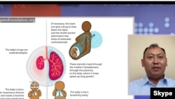 အမေရိကန်ပြည်ထောင်စု ၊ Nebraska ပြည်နယ်အခြေစိုက် CHI Health ပရဟိတဆေးရုံကွန်ယက်က အရည်အသွေးမြှင့်တင်ရေး ညှိနှိုင်းရေးမှူး ဒေါက်တာမျိုးမြင့်အောင်နဲ့ ဗွီအိုအေဝိုင်းတော်သူ အိသန့်စင်ရဲ့ ဆက်သွယ်မေးမြန်းချက်။ (စက်တင်ဘာ ၂၆၊ Skype screen shot)