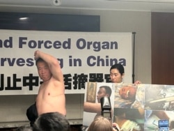 法轮功学员程佩明2024年7月3日在华盛顿举行的新闻发布会上展示活摘器官手术在其身体留下的一条长达35厘米的疤痕。(美国之音薛小山拍摄)