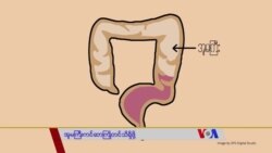 အူမကြီးကင်ဆာကြိုတင်သိရှိဖို့ “လူထုနဲ့ ကျန်းမာရေး” အူမကြီးကင်ဆာကြိုတင်သိရှိဖို့ “လူထုနဲ့ ကျန်းမာရေး”