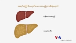 အသည်းအဆီဖုံးရောဂါအန္တရာယ် “လူထုနဲ့ ကျန်းမာရေး”
 အသည်းအဆီဖုံးရောဂါအန္တရာယ် “လူထုနဲ့ ကျန်းမာရေး”