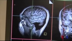 科学研究:男女大脑相似处多于预想 科学研究:男女大脑相似处多于预想