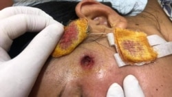 မြဝတီဆန္ဒပြမှု ရာဘာကျည်နဲ့ ပစ်ခတ်လူစုခွဲခဲ့ရ မြဝတီဆန္ဒပြမှု ရာဘာကျည်နဲ့ ပစ်ခတ်လူစုခွဲခဲ့ရ