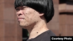 来自香港、现移居台北的濒死艺术家陈伟霖天生患有皮肤癌,全身长满黑色素肿瘤。(美国之音特约记者方琦拍摄)