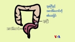 အူမကြီးကင်ဆာ ကုသနိုင်ဖို့ “လူထုနဲ့ ကျန်းမာရေး” အူမကြီးကင်ဆာ ကုသနိုင်ဖို့ “လူထုနဲ့ ကျန်းမာရေး”