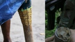 စစ်ကောင်စီလက်နက်ကြီးကြောင့် ဇွန်လအတွင်း ကရင်အရပ်သား၁၂ဦးသေဆုံး
 စစ်ကောင်စီလက်နက်ကြီးကြောင့် ဇွန်လအတွင်း ကရင်အရပ်သား၁၂ဦးသေဆုံး