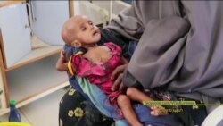 ငတ်မွတ်ကပ်ဘေး ကုလတာဝန်ရှိသူတွေသတိပေး ငတ်မွတ်ကပ်ဘေး ကုလတာဝန်ရှိသူတွေသတိပေး