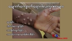 မျောက်ကျောက်ရောဂါ ကာကွယ်ရေး “လူထုနဲ့ ကျန်းမာရေး”  မျောက်ကျောက်ရောဂါ ကာကွယ်ရေး “လူထုနဲ့ ကျန်းမာရေး”