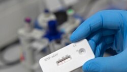 科学家:不能对抗体测试期望值过高 科学家:不能对抗体测试期望值过高