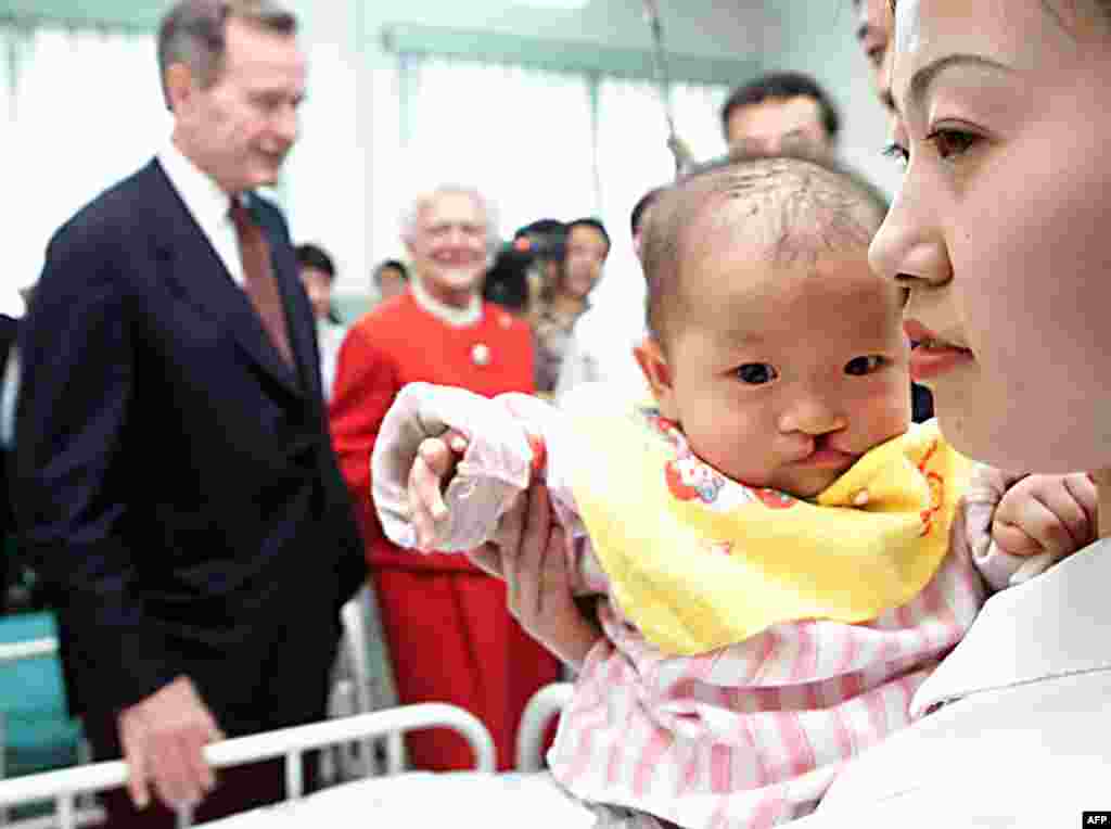 2000年3月2日,前美国总统乔治布什和妻子芭芭拉访问北京一家医院,那里有婴儿腭裂患者将接受“微笑列车”的医生手术。布什夫妇在中国首都参加慈善活动,以帮助中国儿童恢复笑脸。