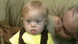 科学家正在研发检测唐氏综合症的手机应用 科学家正在研发检测唐氏综合症的手机应用