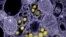 A cluster of SARS-CoV-2 (severe acute respiratory syndrome coronavirus 2) virions -- entire virus particles -- viewed through an electron microscope. (Courtesy: U.S. National Institute of Allergy and Infectious Diseases)