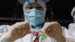 ၂၄ နာရီအတွင်း ဓါတ်ခွဲအတည်ပြု ၃,၆၈၉ ဦး၊ သေဆုံး ၃၃၀ ဦး ၂၄ နာရီအတွင်း ဓါတ်ခွဲအတည်ပြု ၃,၆၈၉ ဦး၊ သေဆုံး ၃၃၀ ဦး