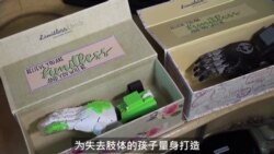 少女发明家用爱心为残疾儿童打造义肢 少女发明家用爱心为残疾儿童打造义肢