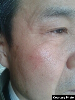 程海律师被打(图片来源:梁小军律师推特)