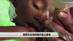 麻疹在全球范围内卷土重来 麻疹在全球范围内卷土重来