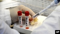 H1N1 တုပ်ကွေးပိုးစမ်းသပ်နေစဉ်