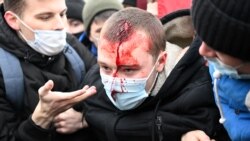 အတိုက်အခံ ဆန္ဒပြသမားတွေ ဖမ်းဆီးတဲ့ ရုရှားကို အရေးယူဒဏ်ခတ်ဖို့ ပြင်သစ် တိုက်တွန်း အတိုက်အခံ ဆန္ဒပြသမားတွေ ဖမ်းဆီးတဲ့ ရုရှားကို အရေးယူဒဏ်ခတ်ဖို့ ပြင်သစ် တိုက်တွန်း