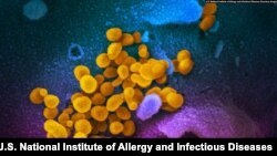 SARS-CoV-2 virions emerge from a human cell after replicating. Despite their apparent longevity, the virions can be destroyed with warm, soapy water. (Courtesy: U.S. National Institute of Allergy and Infectious Diseases)