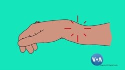 ခြေထောက် သေနတ်ထိဒဏ်ရာ ခြေထောက် သေနတ်ထိဒဏ်ရာ