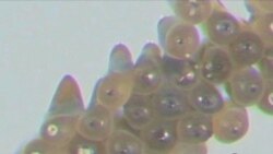 У техаській лабораторії вивчають вірус Західного Нілу У техаській лабораторії вивчають вірус Західного Нілу