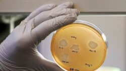 လည်ချောင်းနာခြင်း (အပိုင်း - ၁) လည်ချောင်းနာခြင်း (အပိုင်း - ၁)