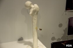 香港六四纪念馆展出从六四学生活动人士张健腿部取出的子弹 (美国之音记者申华拍摄)