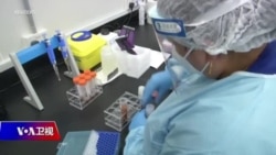 时事大家谈:美两大制药暂停临床 北京武汉预约接种风险知多少? 时事大家谈:美两大制药暂停临床 北京武汉预约接种风险知多少?