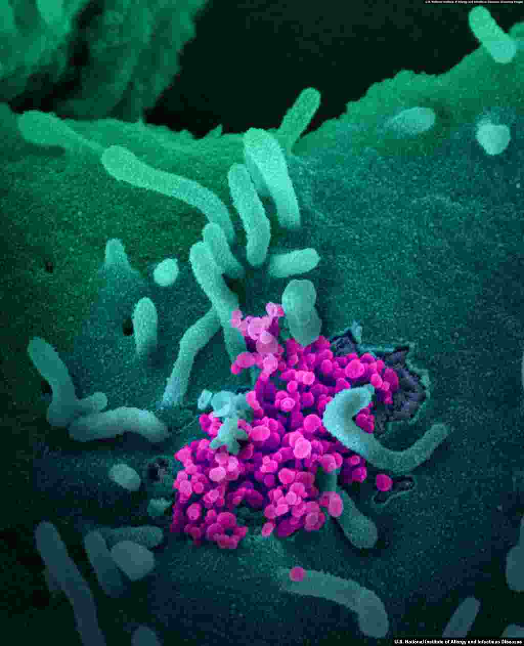 Once inside the cell, the virus releases genetic material that effectively tricks the host cell into replicating the invading virus thousands of times. (Courtesy: U.S. National Institute of Allergy and Infectious Diseases)