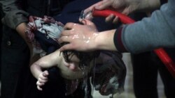 ဆီးရီးယားဓါတုတိုက်ခိုက်မှု တုံ့ပြန်ဖို့ ကန် ၂၄ နဲ့ ၄၈ နာရီအတွင်း ဆုံးဖြတ်မည် ဆီးရီးယားဓါတုတိုက်ခိုက်မှု တုံ့ပြန်ဖို့ ကန် ၂၄ နဲ့ ၄၈ နာရီအတွင်း ဆုံးဖြတ်မည်