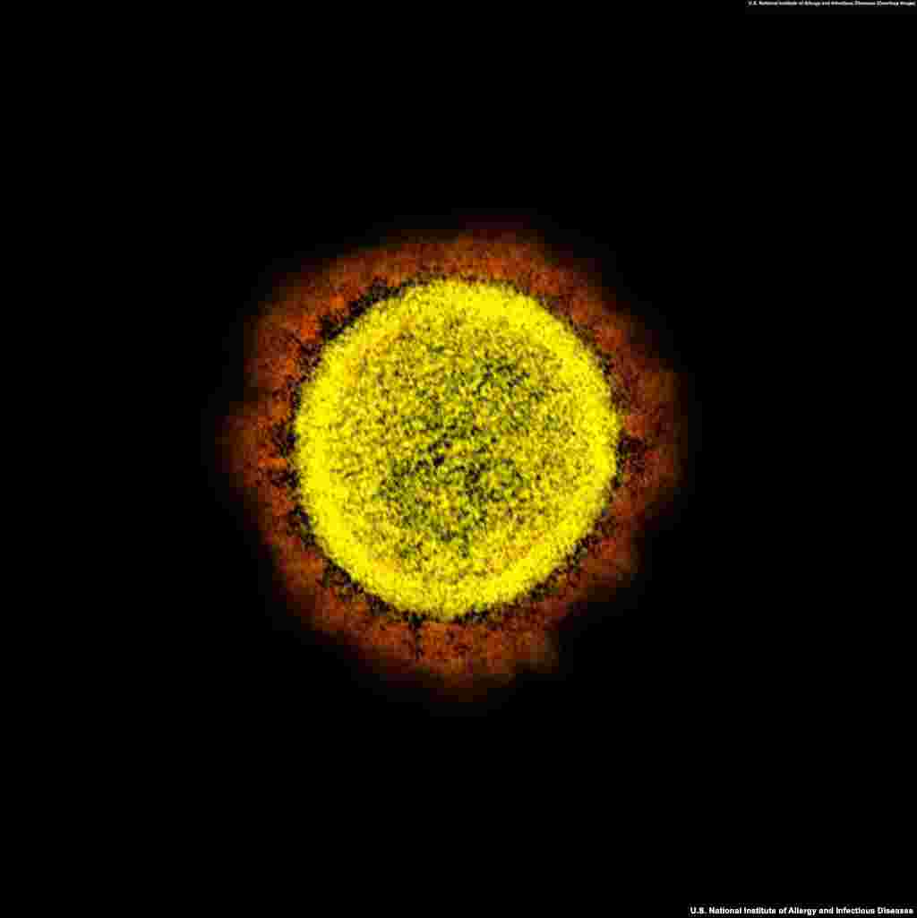 A SARS-CoV-2 virion. Coronaviruses are named for the appearance of a halo or crown when viewed under a microscope. "Corona" is the Latin word for crown or halo.(Courtesy: U.S. National Institute of Allergy and Infectious Diseases)