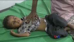 ကမ္ဘာတဝှမ်း ဝက်သက်ရောဂါ ပြန်ဖြစ်ပွားနေ ကမ္ဘာတဝှမ်း ဝက်သက်ရောဂါ ပြန်ဖြစ်ပွားနေ