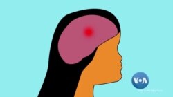 ဦးခေါင်းထိခိုက်မှု ရှေးဦးသူနာပြု ဦးခေါင်းထိခိုက်မှု ရှေးဦးသူနာပြု