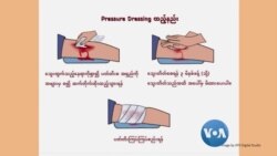 ခြေလက်ကျိုးမှု ရှေးဦးသူနာပြု ခြေလက်ကျိုးမှု ရှေးဦးသူနာပြု