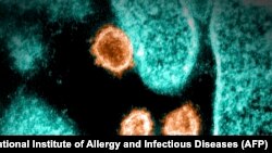 美国国家过敏症和传染病研究所提供的电子显微镜下的SARS-CoV-2病毒照片。(图片来源:AFP Photo/NIAID)