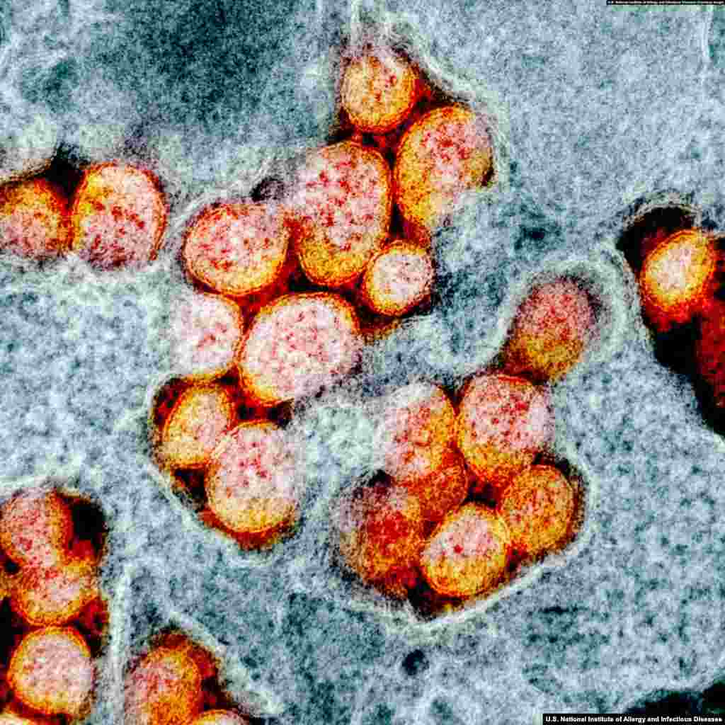 Each coronavirus virion is around 120 nanometers in diameter, meaning about 750 of them could fit across the width of a human hair. (Courtesy: U.S. National Institute of Allergy and Infectious Diseases)