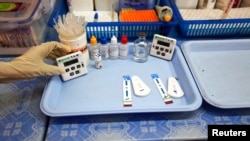 HIV ရောဂါရှိမရှိ စစ်ဆေးနေစဉ်