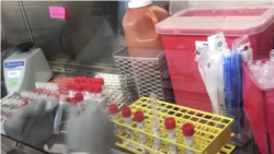 ကိုဗစ် ၁၉ ရောဂါပိုးရှိမရှိ အမြန်စစ်ဆေးနည်း ကိုဗစ် ၁၉ ရောဂါပိုးရှိမရှိ အမြန်စစ်ဆေးနည်း