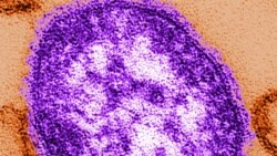 ဝက်သက်ရောဂါ ပျံ့နံှ့မှု ဝက်သက်ရောဂါ ပျံ့နံှ့မှု