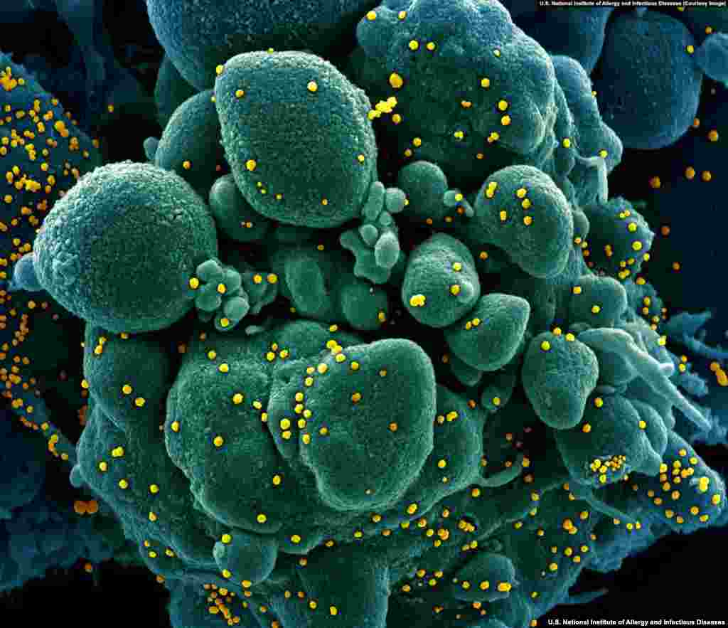 SARS-CoV-2 virions dotting the surface of a human cell. (Courtesy: U.S. National Institute of Allergy and Infectious Diseases)