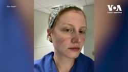 Згоряють на полі битви: У США нестача медичних працівників, які не витримують невпинного тиску пандемії. Відео Згоряють на полі битви: У США нестача медичних працівників, які не витримують невпинного тиску пандемії. Відео