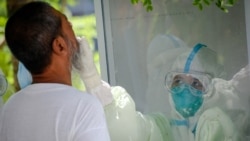 မြန်မာ့ဆေးသုတေသနဌာနရဲ့ ကိုဗစ်ရောဂါရှိမရှိ စစ်ဆေး ဆောင်ရွက်ပုံ အဆင့်ဆင့် မြန်မာ့ဆေးသုတေသနဌာနရဲ့ ကိုဗစ်ရောဂါရှိမရှိ စစ်ဆေး ဆောင်ရွက်ပုံ အဆင့်ဆင့်