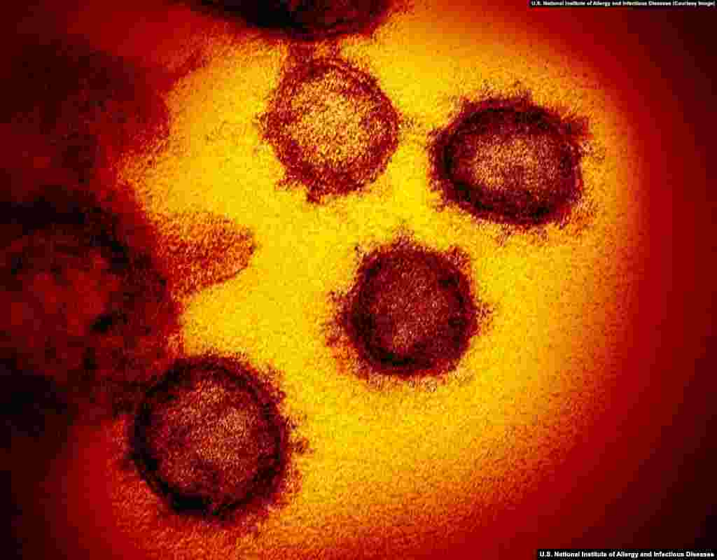 A cluster of SARS-CoV-2 (severe acute respiratory syndrome coronavirus 2) virions -- entire virus particles -- viewed through an electron microscope. (Courtesy: U.S. National Institute of Allergy and Infectious Diseases)
