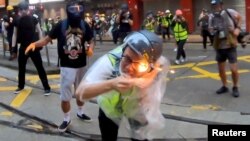 在香港抗议活动中被燃烧装置击中受伤的香港记者(2019年10月6日)