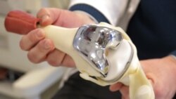 Giật giật trong đầu gối và phình động mạch sau gối (popliteal aneurysm) Giật giật trong đầu gối và phình động mạch sau gối (popliteal aneurysm)