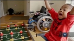 Історія про хлопчика, який два роки тому успішно переніс першу в світі дитячу трансплантацію обох рук. Відео